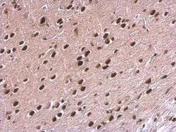 Invitrogen NPAS1 Polyclonal Antibody 100 &mu;L; Unconjugated:Antibodies,