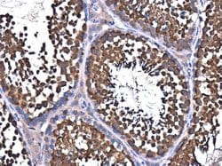 Invitrogen NSF Polyclonal Antibody 100 &mu;L; Unconjugated:Antibodies,