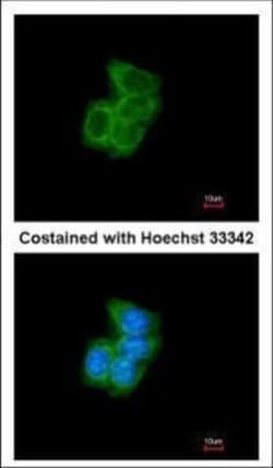 Invitrogen PDI Polyclonal Antibody 100 &mu;L; Unconjugated:Antikörper