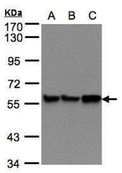 Invitrogen PDI Polyclonal Antibody 100 &mu;L; Unconjugated:Antibodies,