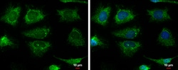 Invitrogen Pyruvate Carboxylase Polyclonal Antibody 100 &mu;L; Unconjugated:Antibodies,