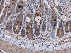 Invitrogen Pyruvate Carboxylase Polyclonal Antibody 100 &mu;L; Unconjugated:Antibodies,