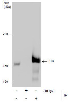 Invitrogen Pyruvate Carboxylase Polyclonal Antibody 100 &mu;L | Buy Online | Invitrogen&trade; | Fisher Scientific