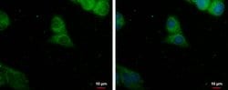 Invitrogen PDE8A Polyclonal Antibody 100 &mu;L; Unconjugated:Antibodies,