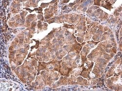 Invitrogen PLCB2 Polyclonal Antibody 100 &mu;L | Buy Online | Invitrogen&trade; | Fisher Scientific