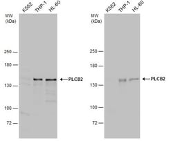 Invitrogen PLCB2 Polyclonal Antibody 100 &mu;L | Buy Online | Invitrogen&trade; | Fisher Scientific