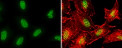 Invitrogen POLE Polyclonal Antibody 100 &mu;L; Unconjugated:Antibodies,