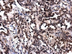 Invitrogen POLE Polyclonal Antibody 100 &mu;L; Unconjugated:Antibodies,