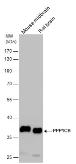 Invitrogen PP1 beta Polyclonal Antibody 100 &mu;L; Unconjugated:Antibodies,
