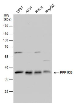 Invitrogen PP1 beta Polyclonal Antibody 100 &mu;L; Unconjugated:Antibodies,