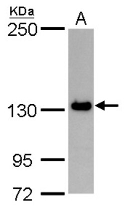 Invitrogen PPP1R3A Polyclonal Antibody 100 &mu;L; Unconjugated:Antibodies,