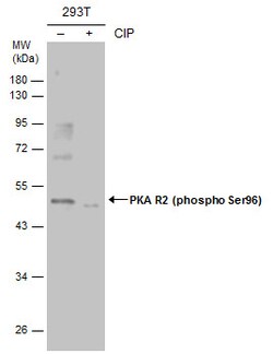 Invitrogen Phospho-PRKAR2A (Ser96) Polyclonal Antibody 100 &mu;L; Unconjugated:Antibodies,