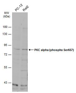 Invitrogen Phospho-PKC alpha (Ser657) Polyclonal Antibody 100 &mu;L; Unconjugated:Antibodies,