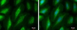Invitrogen PKC mu Polyclonal Antibody 100 &mu;L; Unconjugated:Antibodies,