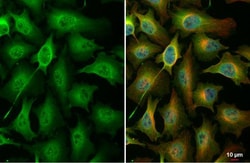 Invitrogen Phospho-PKC zeta (Thr410) Polyclonal Antibody 100 &mu;L; Unconjugated:Antibodies,