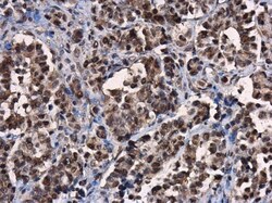 Invitrogen ERK2 Polyclonal Antibody 100 &mu;L; Unconjugated:Antibodies,