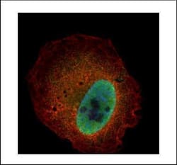 Invitrogen Kallikrein 6 Polyclonal Antibody 100 &mu;L | Buy Online | Invitrogen&trade; | Fisher Scientific