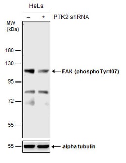 Invitrogen Phospho-FAK (Tyr407) Polyclonal Antibody 100 &mu;L; Unconjugated:Antibodies,