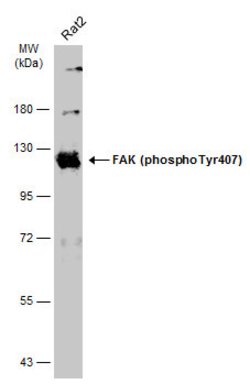 Invitrogen Phospho-FAK (Tyr407) Polyclonal Antibody 100 &mu;L; Unconjugated:Antibodies,
