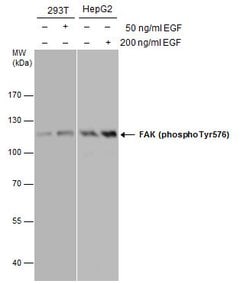 Invitrogen Phospho-FAK (Tyr576) Polyclonal Antibody 100 &mu;L | Buy Online | Invitrogen&trade; | Fisher Scientific