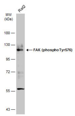 Invitrogen Phospho-FAK (Tyr576) Polyclonal Antibody 100 &mu;L | Buy Online | Invitrogen&trade; | Fisher Scientific