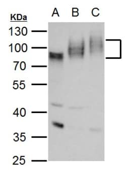 Invitrogen CD155 Polyclonal Antibody 100 &mu;L; Unconjugated:Antibodies,
