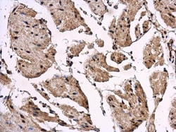 Invitrogen REST Polyclonal Antibody 100 &mu;L; Unconjugated:Antibodies,
