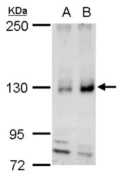 Invitrogen REST Polyclonal Antibody 100 &mu;L; Unconjugated:Antibodies,