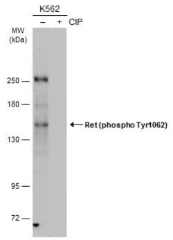 Invitrogen Phospho-RET (Tyr1062) Polyclonal Antibody 100 &mu;L; Unconjugated:Antibodies,