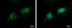 Invitrogen RGS7 Polyclonal Antibody 100 &mu;L; Unconjugated:Antibodies,