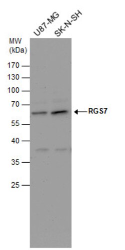 Invitrogen RGS7 Polyclonal Antibody 100 &mu;L; Unconjugated:Antibodies,