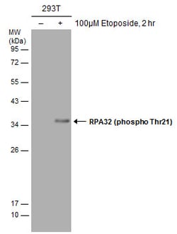 Invitrogen Phospho-RPA2 (Thr21) Polyclonal Antibody 100 &mu;L | Buy Online | Invitrogen&trade; | Fisher Scientific