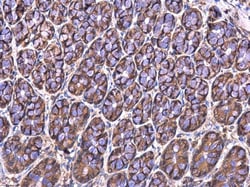 MRPL23 Polyclonal Antibody:Antibodies, Polyclonal