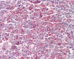 MRPL23 Polyclonal Antibody:Antibodies, Polyclonal