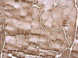 Invitrogen RSK2 Polyclonal Antibody 100 &mu;L | Buy Online | Invitrogen&trade; | Fisher Scientific