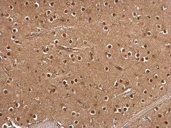 Invitrogen RSK2 Polyclonal Antibody 100 &mu;L | Buy Online | Invitrogen&trade; | Fisher Scientific