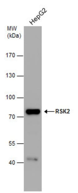 Invitrogen RSK2 Polyclonal Antibody 100 &mu;L | Buy Online | Invitrogen&trade; | Fisher Scientific
