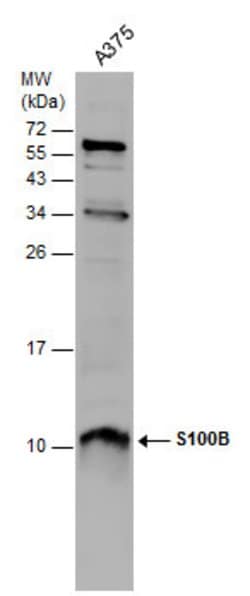 Invitrogen S100B Polyclonal Antibody 100 &mu;L; Unconjugated:Antibodies,