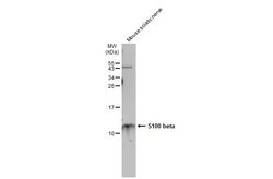 Invitrogen S100B Polyclonal Antibody 100 &mu;L; Unconjugated:Antibodies,