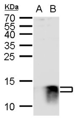 Invitrogen S100B Polyclonal Antibody 100 &mu;L; Unconjugated:Antibodies,