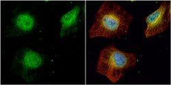 Invitrogen SET Polyclonal Antibody 100 &mu;L; Unconjugated:Antibodies,