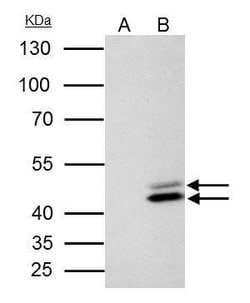 Invitrogen SET Polyclonal Antibody 100 &mu;L; Unconjugated:Antibodies,