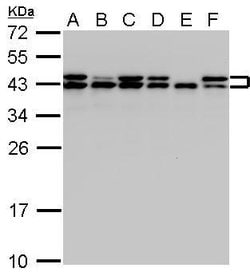 Invitrogen SET Polyclonal Antibody 100 &mu;L; Unconjugated:Antibodies,
