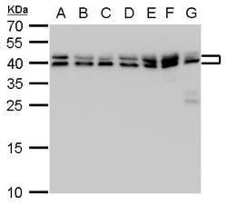 Invitrogen SET Polyclonal Antibody 100 &mu;L; Unconjugated:Antibodies,