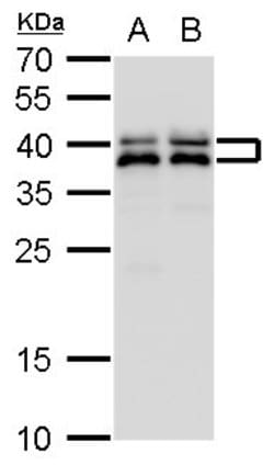 Invitrogen SET Polyclonal Antibody 100 &mu;L; Unconjugated:Antibodies,