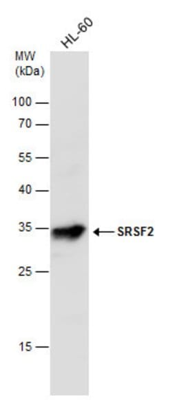 Invitrogen SRSF2 Polyclonal Antibody 100 &mu;L; Unconjugated:Antibodies,