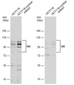 Invitrogen SKI Polyclonal Antibody 100 &mu;L; Unconjugated:Antikroppar