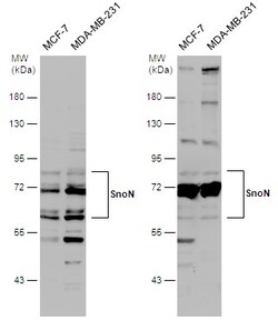 Invitrogen SnoN Polyclonal Antibody 100 &mu;L | Buy Online | Invitrogen&trade; | Fisher Scientific