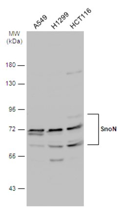 Invitrogen SnoN Polyclonal Antibody 100 &mu;L | Buy Online | Invitrogen&trade; | Fisher Scientific