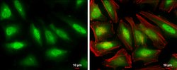 Invitrogen SKP2 Polyclonal Antibody 100 &mu;L; Unconjugated:Antibodies,